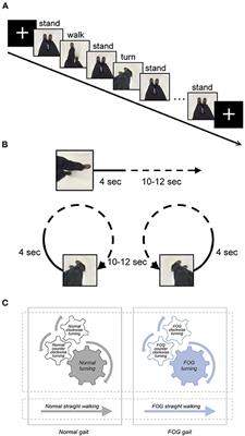 Gait-Related Brain Activation During Motor Imagery of Complex and Simple Ambulation in Parkinson's Disease With Freezing of Gait